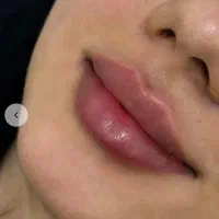 تخفیف ۳۰درصدی کلینیک آرایAray