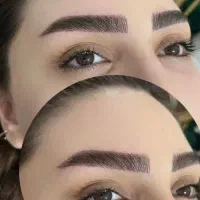 میکروفیبروز ابرو فقط ۲ تومن با ترمیم رایگان