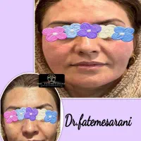 دیگه ناراحت لاغری صورتت نباش...