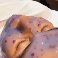 تخفیف ۳۰ درصدی فیشال درمانی و پاکسازی