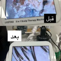 فروش مواد و دستگاه های اسکراب کف سر