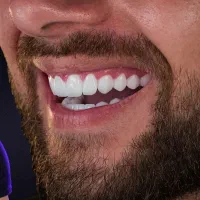 دم قسط/کامپوزیت/لمینیت/روکش/ هر فک ۴تومن