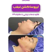 لیپو شکم،ابدو،غبغب،ماموپلاستی،فیلر بادی پروتزسینه