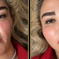 ساکشن 10میلیون با مشاوره حرفهای