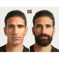 ترمیم ریش و مو کاملا غیر تهاجمی و آسان