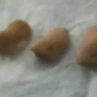 سه عدد سمعک سالم
