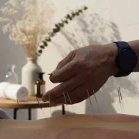 آموزش طب سوزنی