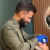 کاشت مو با متد SuperFUE، متد شیرازی دکتر چالشی