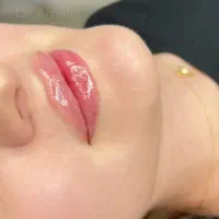 اف ۵۰٪ مطب پوست مو لیزر الکساندرایت