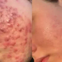 فیشیال تخصصی وجوانسازی پوست وآموزش درمطب