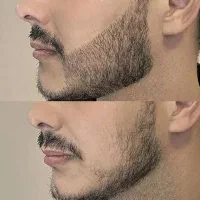 این سرم غوغا میکنه
