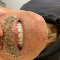 دندانسازی رز دنت شعبه اصلی تربت حیدریه ودوم مشهد