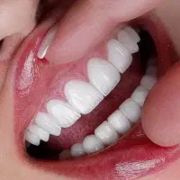 نیروی لابرتوار دندانسازی ثابت