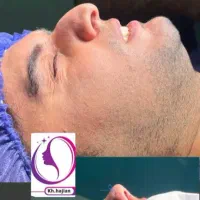جراحی زیبایی بینی  نقد و اقساط