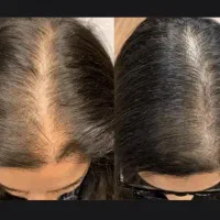 زیبایی رو به خودت هدیه بده