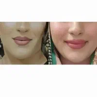 تپلی صورت