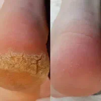 شید لب خط چشم میکرو ابرو تخصصی تتو بدن