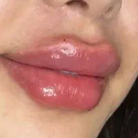 جوان تر دیده شود ،بدون جراحی