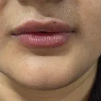 کلینیک زیبایی پوست و مو