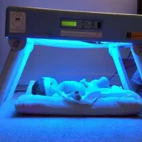 اجاره انواع دستگاه زردی (فتوتراپی)