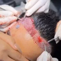 زیبایی چهره توبا. کاشتمو وابروچندبرابرکن