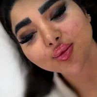 تزریق ژل و بوتاکس