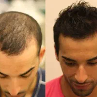 هزینه کمتر رویش بهتر