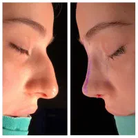 چراحی زیبایی در بیمارستان خصوصی  با تیم جراحی خاص