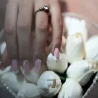 ۱۰ نفر اول (کاشت و ترمیم)ژلیش پا فقط ۱۰۰
