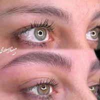 میکرو فیبروز شیدینگ آموزش تضمینی VIP پونک