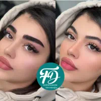 تخفیف50%میکروبلدینگ/فیبروز/شیدلب