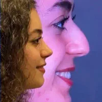 جشنواره تخفیفی زیبایی صورت و بینی