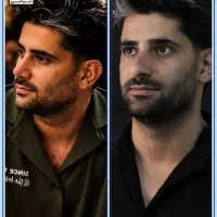 عمل بینی گوشتی و استخوانی / اقساط/شیراز