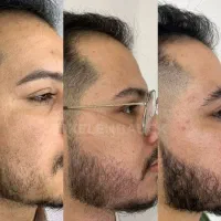 کمک میکنم از افسردگی در بیای