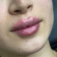 پزشک عمومی یا پوست مو