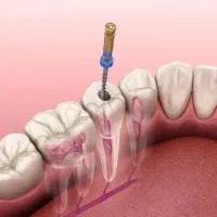 خدمات دندانپزشکی در بلوار معلم