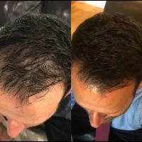 ریشه ای حلش کن