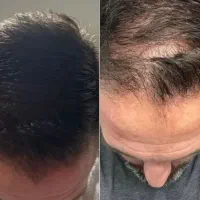 وقتی ظاهر برات مهمه