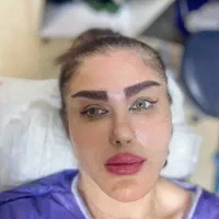 مدل کاشت ابرو سوپر لیفت کاملاتضمینی فقط ۱۲ تومن
