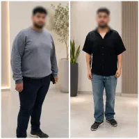اسلیو، بای‌پس، لیپو ، ابدو ، مامو و ژنیکو