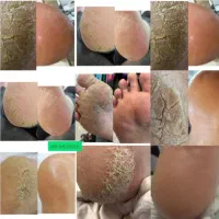 آموزش و خدمات پدیکور و کفسابی پا