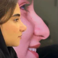 جشنواره تابستانه عمل بینی
