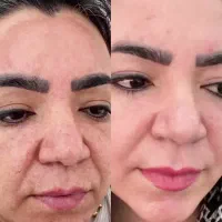 راز پوست خوب فقط ژنتیک نیست