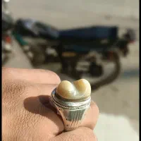 انگشتر کهنه