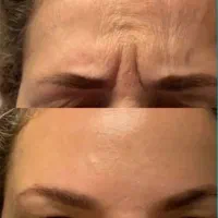 کرم جوانساز بیوممتیک