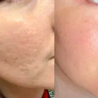 کرم معجزه اصل با صابون زردچوبه صندل اصل