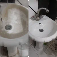 رسوب زدا ..چربیزدا و جرمگیر