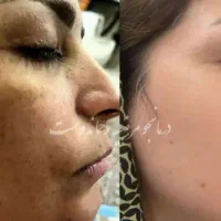 روتین طبیعی  قبل از روش های پر هزینه