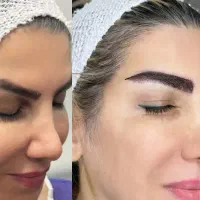 آفرمیکروکاشت ابروتضمینی تنهامتد(فاین برو)بدون اسیب
