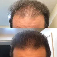 تا کی میخوای خودتو قایم کنی